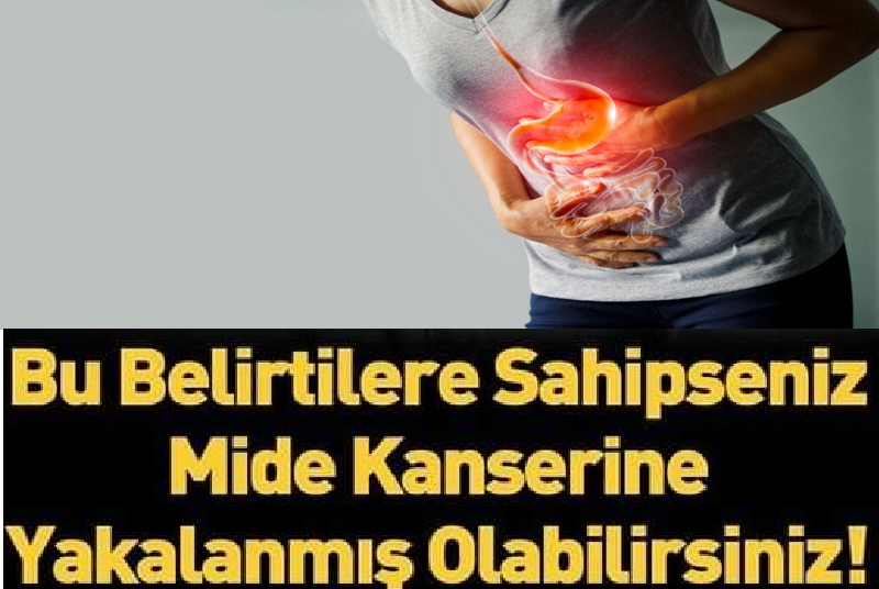 Mide Kanseri Olduğunuzu Gösteren Belirtiler Neler? Bu Belirtilere Dikkat! 