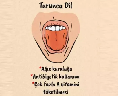 Kırmızı dil rengi bu hastalığın işareti! Doktorlar dilimize bu yüzden bakıyormuş