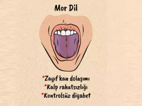 Kırmızı dil rengi bu hastalığın işareti! Doktorlar dilimize bu yüzden bakıyormuş