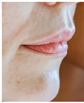 Vücudunuzdaki benler bu hastalığın habercisi! Eğer Vücudunuzdaki Ben Sayısı Bu Sayıdaysa, Hemen Bir Doktora Görünün