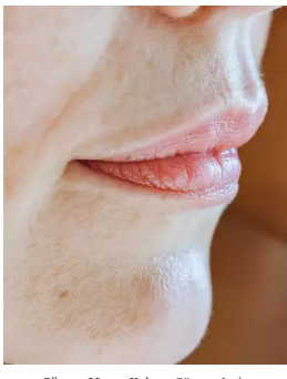 Vücudunuzdaki benler bu hastalığın habercisi! Eğer Vücudunuzdaki Ben Sayısı Bu Sayıdaysa, Hemen Bir Doktora Görünün