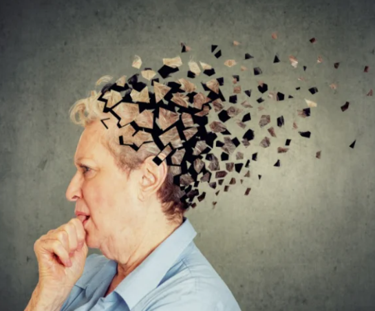 Alzheimer'ın asıl belirtisi unutkanlık değilmiş! Uzmanlar uyardı. Asıl bu belirtiye dikkat!