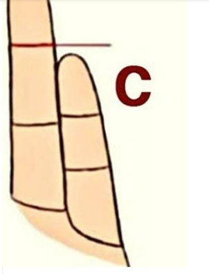 Parmak şekli böyle olanlar dikkat: Uzmanlar açıkladı, meğer arasında bağlantı varmış