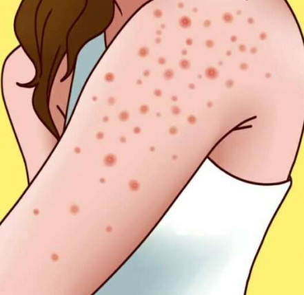  Gluten Duyarlılığınızın Olduğunun 9 Belirtisi! Bu Belirtiler Varsa Dikkat!