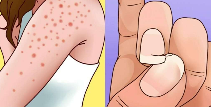  Gluten Duyarlılığınızın Olduğunun 9 Belirtisi! Bu Belirtiler Varsa Dikkat!