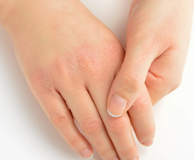 Vücudunuzun Size Ters Giden Bir Şeyler Olduğunu Bu Şekilde Anlatıyor