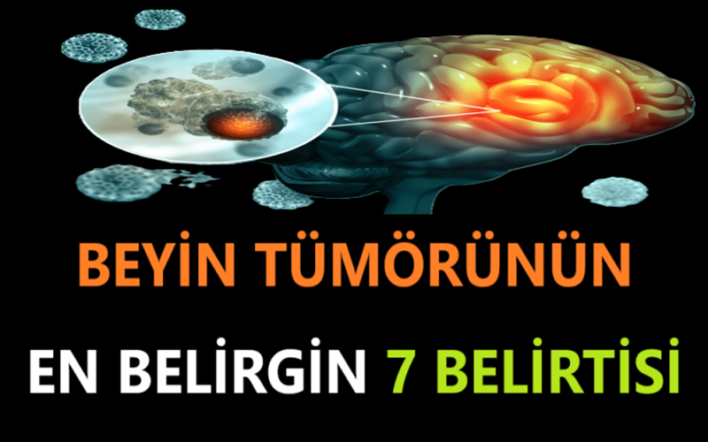 Beyin tümörünün en belirgin 7 belirtisi
